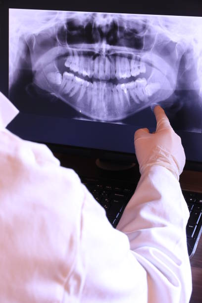 Best Emergency Dental Care for Abscessed Tooth in Middletown, CT