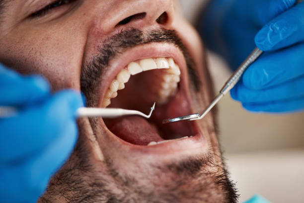 Best Emergency Dentist for Lost Fillings or Crowns in Middletown, CT